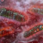 ‘You Have Died Of Dysentery’: What To Know About The Growing Shigella Health Concern