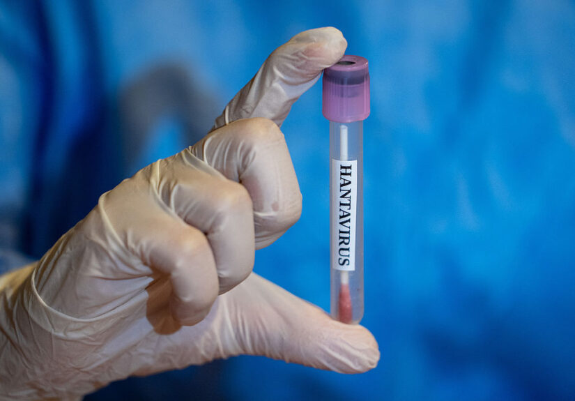 Hantavirus: 2 Georgia Residents Under Watch After Contaminated Cruise, Here’s What You Need To Know
