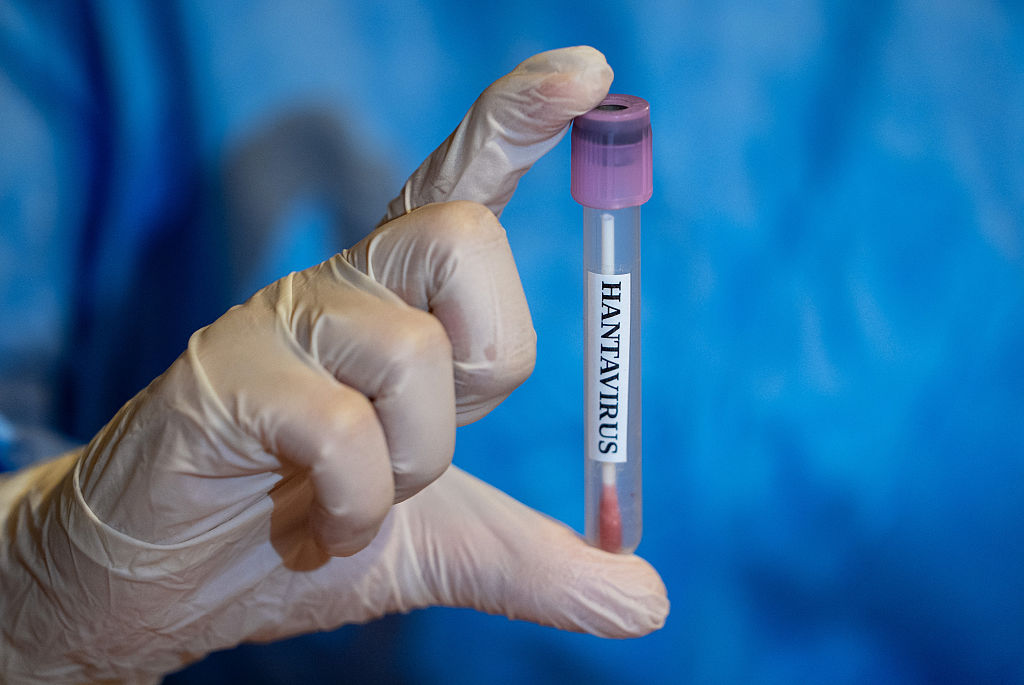 Hantavirus: 2 Georgia Residents Under Watch After Contaminated Cruise, Here’s What You Need To Know