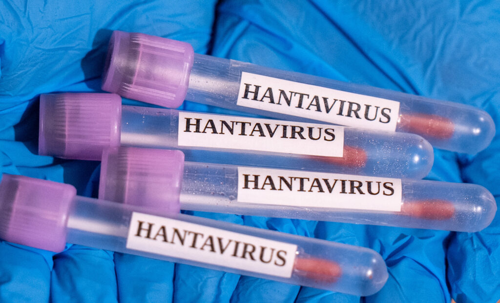 UPDATE: Cruise Ship Evacuations Begin After Hantavirus Outbreak Reportedly Leaves Multiple Dead (VIDEO)