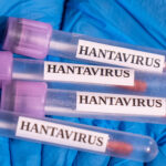 UPDATE: Cruise Ship Evacuations Begin After Hantavirus Outbreak Reportedly Leaves Multiple Dead (VIDEO)