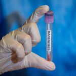 Hantavirus Cruise Deaths Spark Fear As Officials Push Back On Panic & The Internet Has Flashbacks